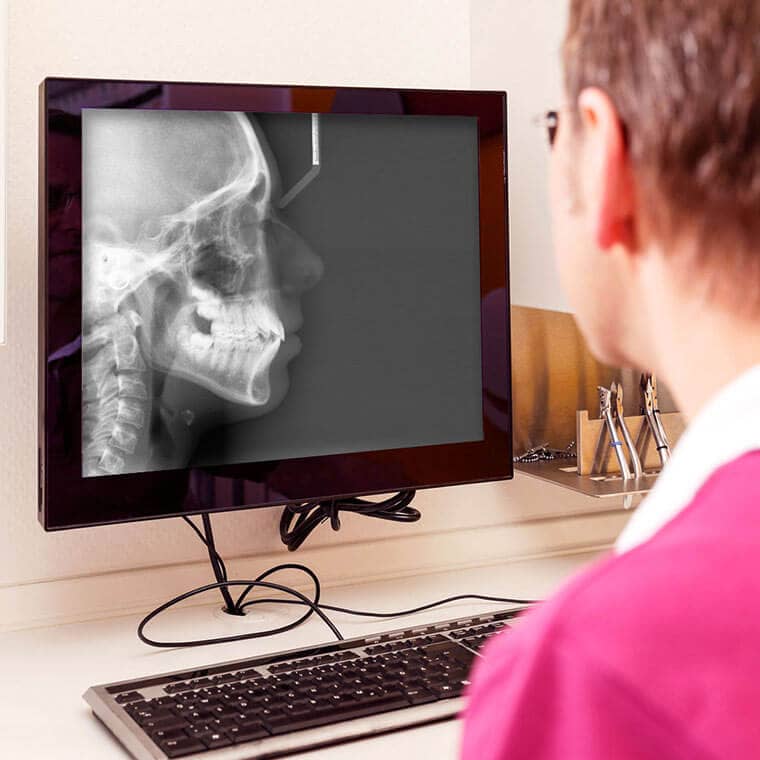 X-ray image on a monitor