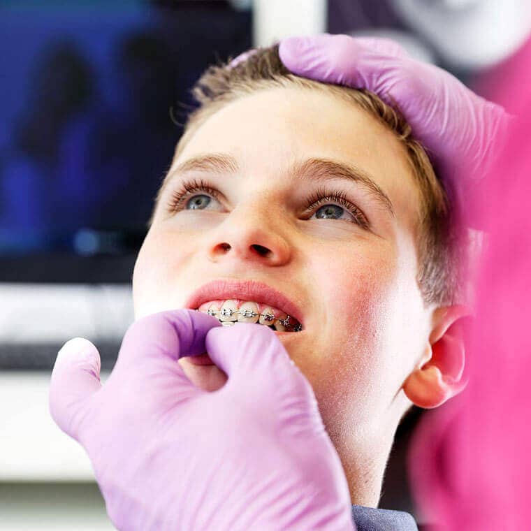 Dental check for fixed brackets